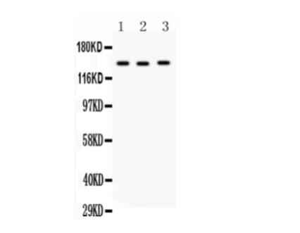 RTN3 Polyclonal Antibody