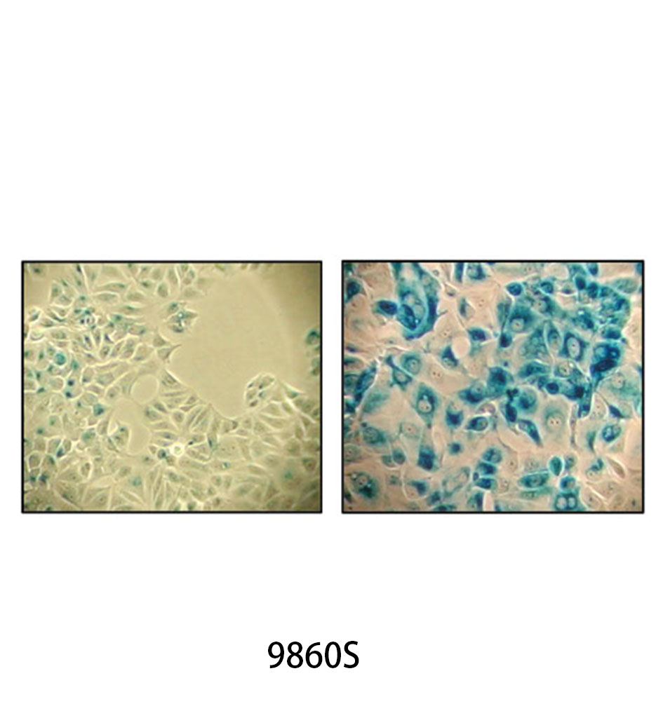 Senescence β-Galactosidase Staining Kit