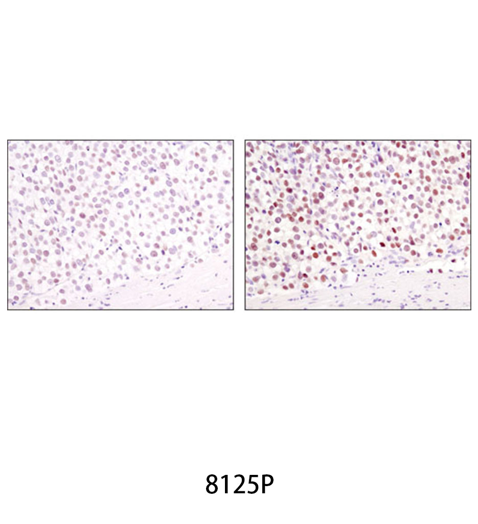 SignalStain Boost IHC Detection Reagent (HRP Mouse)