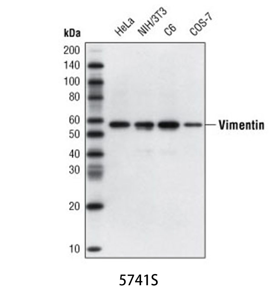 Vimentin (D21H3) XP Rabbit mAb