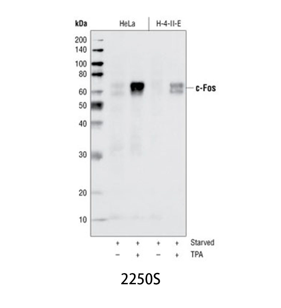 c-Fos (9F6) Rabbit mAb