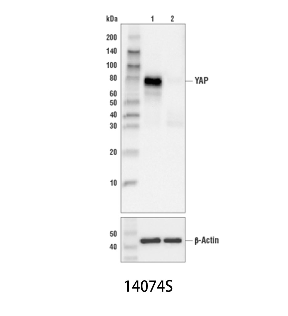 YAP (D8H1X) XP Rabbit mAb