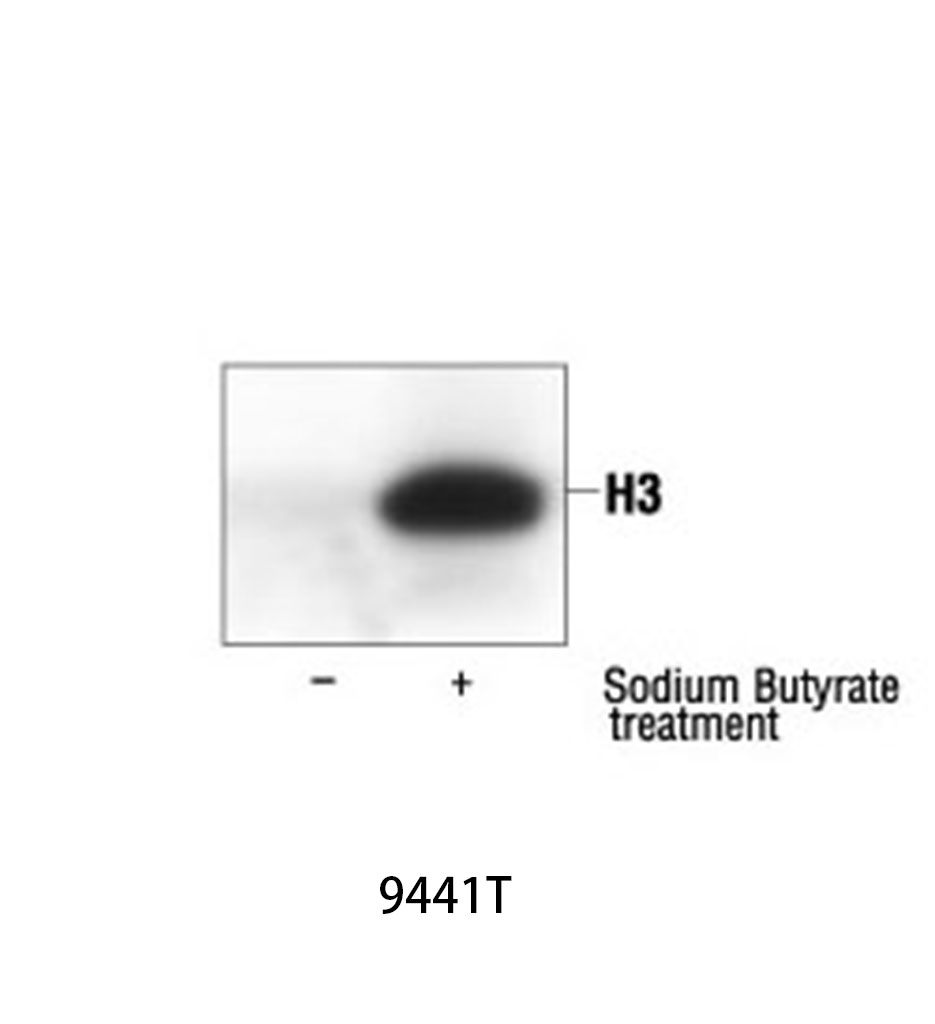 Acetylated-Lysine Antibody