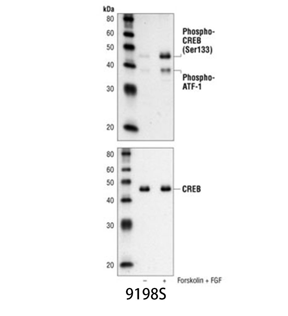 Phospho-CREB (Ser133) (87G3) Rabbit mAb