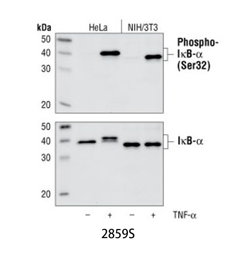 Phospho-IκBα (Ser32) (14D4) Rabbit mAb
