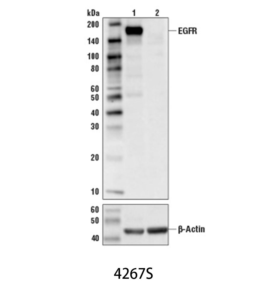 EGF Receptor (D38B1) XP Rabbit mAb