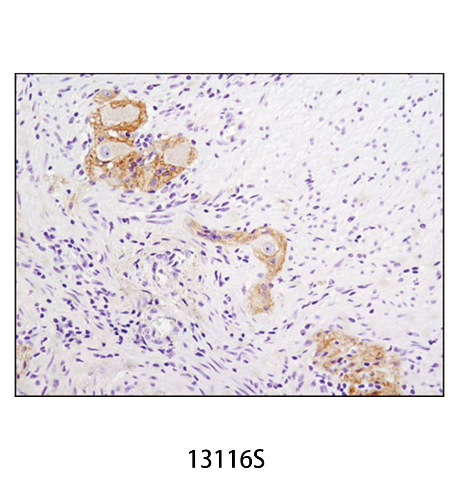 N-Cadherin (D4R1H) XP Rabbit mAb