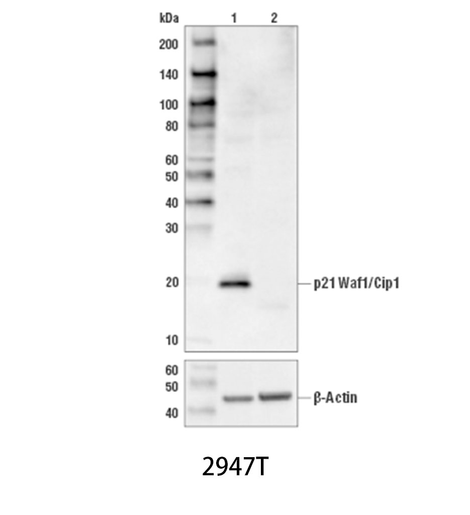 p21 Waf1/Cip1 (12D1) Rabbit mAb