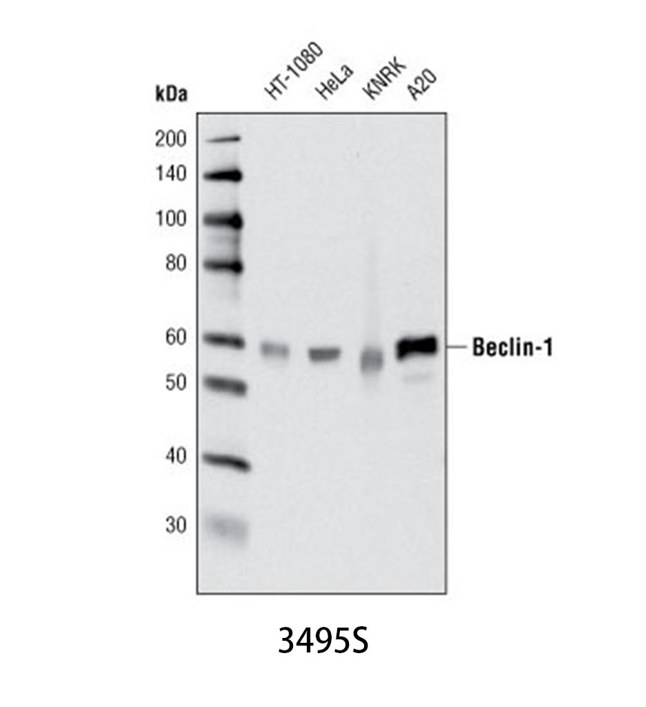 Beclin-1 (D40C5) Rabbit mAb