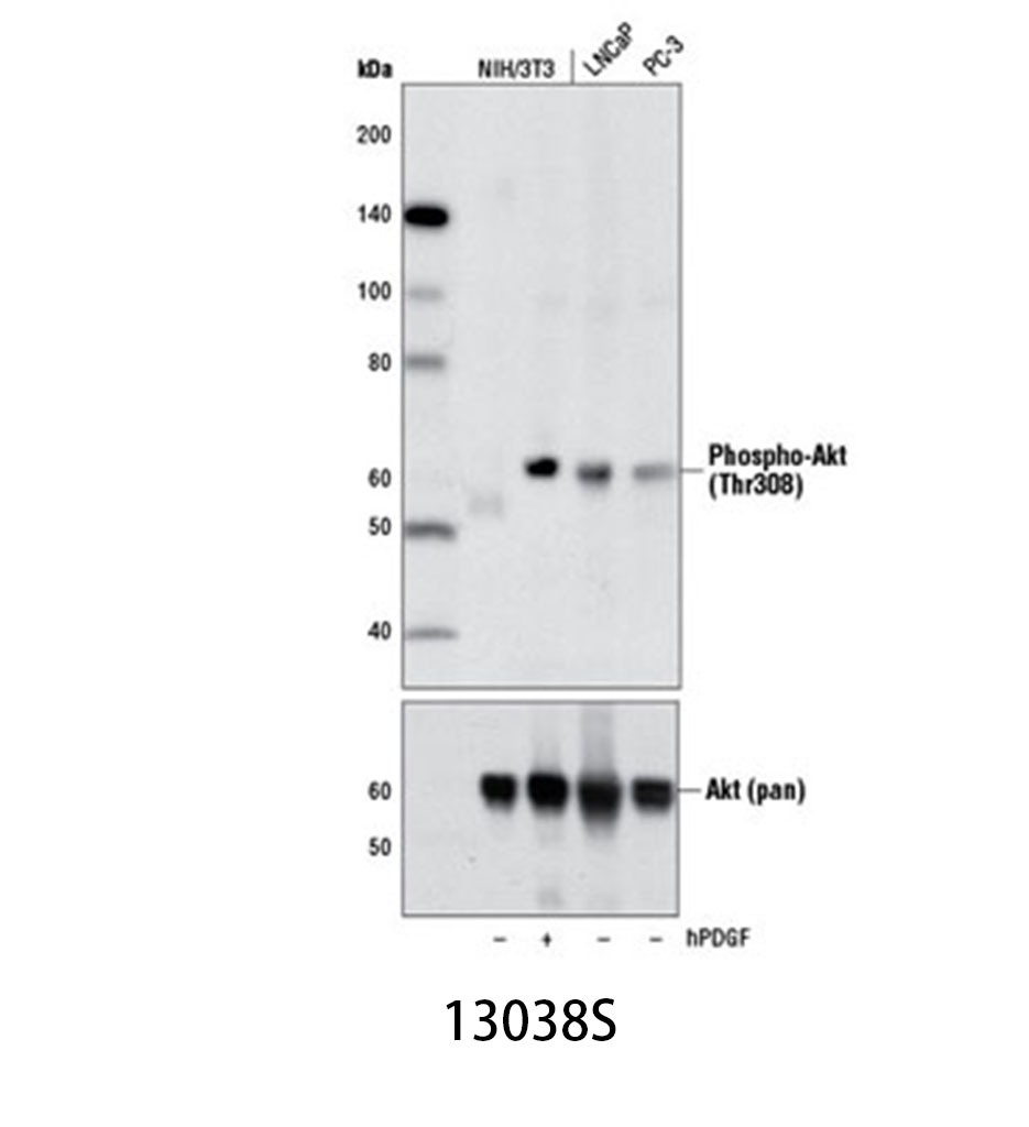 Phospho-Akt (Thr308) (D25E6) XP Rabbit mAb