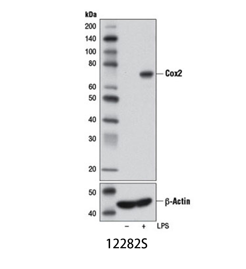 Cox2 (D5H5) XP Rabbit mAb