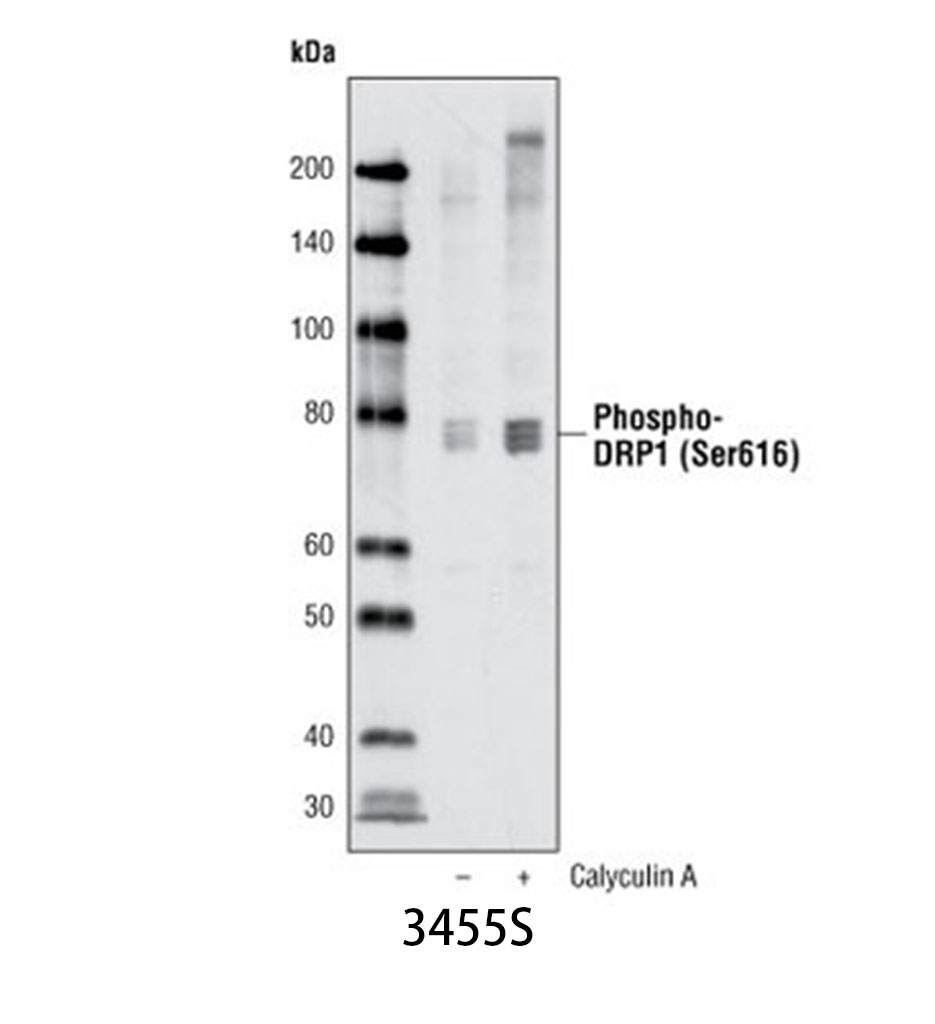 Phospho-DRP1 (Ser616) Antibody