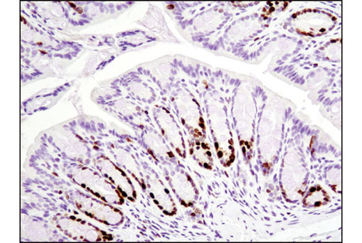 Ki-67 (D3B5) Rabbit mAb (Mouse Preferred; IHC Formulated)