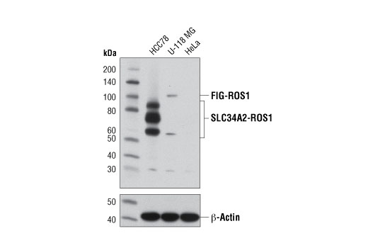 ROS1 (D4D6) Rabbit mAb