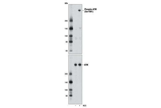 Phospho-ATM (Ser1981) (D25E5) Rabbit mAb