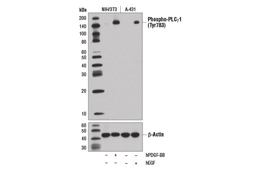 Phospho-PLCγ1 (Tyr783) (D6M9S) Rabbit mAb