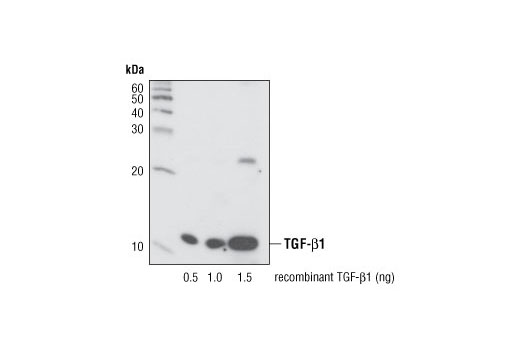 TGF-β (56E4) Rabbit mAb