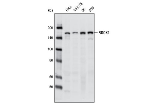 ROCK1 (C8F7) Rabbit mAb