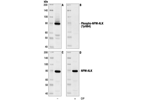 Phospho-ALK (Tyr1604) Antibody