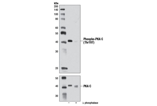 Phospho-PKA C (Thr197) (D45D3) Rabbit mAb
