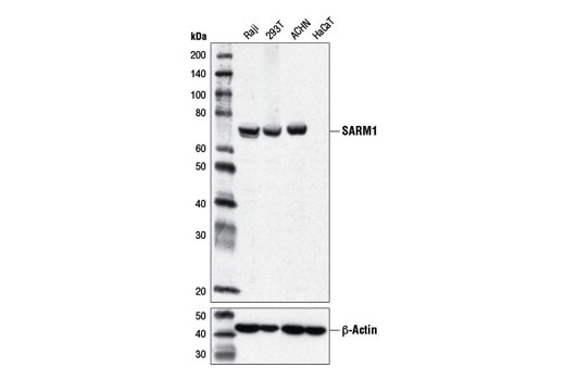SARM1 (D2M5I) Rabbit mAb
