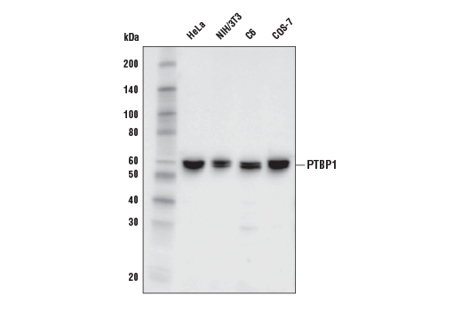 PTBP1 (E5O2S) Rabbit mAb