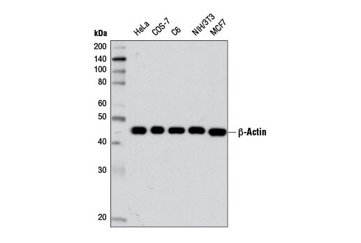 β-Actin (D6A8) Rabbit mAb