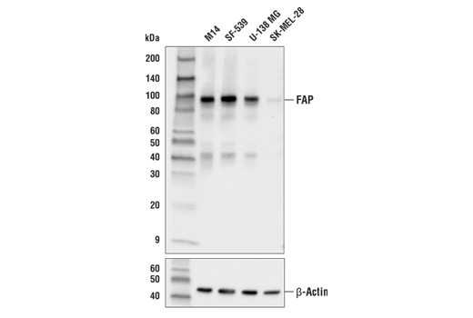 FAP (E1V9V) Rabbit mAb