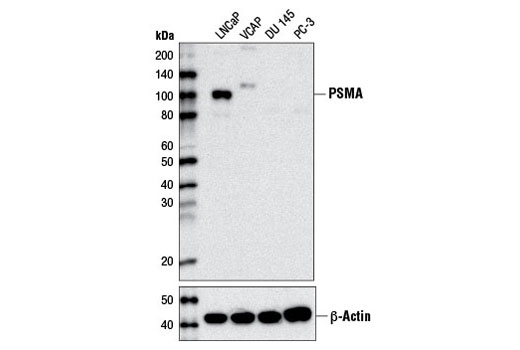 Prostate Specific Membrane Antigen (D7I8E) XP Rabbit mAb
