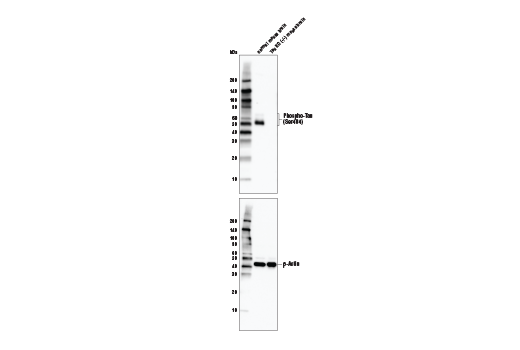 Phospho-Tau (Ser404) (D2Z4G) Rabbit mAb (IF preferred)