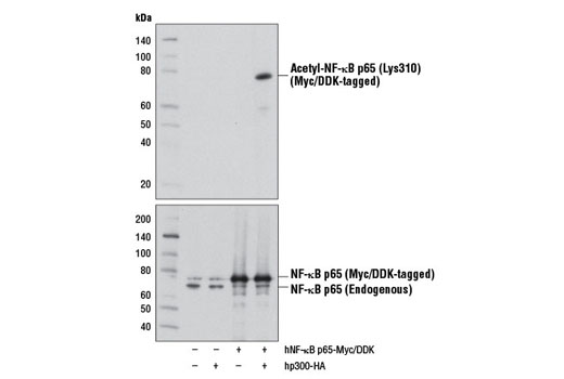 NF-κB p65 Antibody Sampler Kit