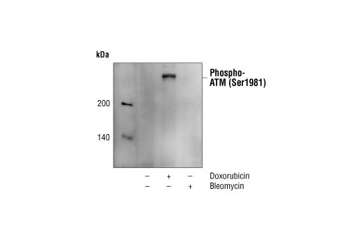 Phospho-ATM (Ser1981) (10H11.E12) Mouse mAb