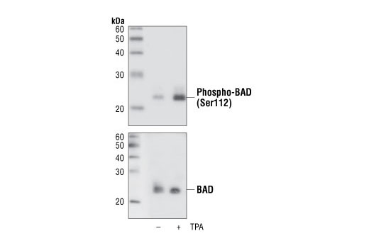 Phospho-Bad (Ser112) (40A9) Rabbit mAb