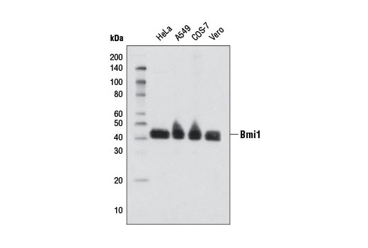 Bmi1 (D20B7) XP Rabbit mAb