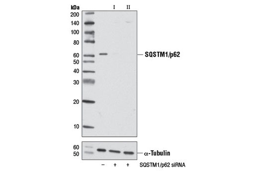 SignalSilence SQSTM1/p62 siRNA I