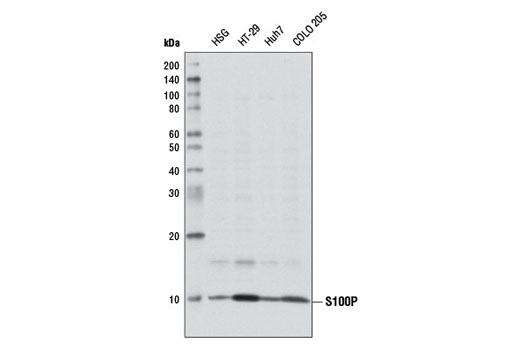 S100P Antibody