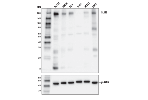 SLIT2 (E8W7Y) Rabbit mAb