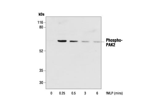 Phospho-PAK1 (Thr423)/PAK2 (Thr402) Antibody