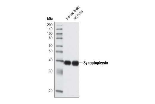 Synaptophysin (D35E4) Rabbit mAb