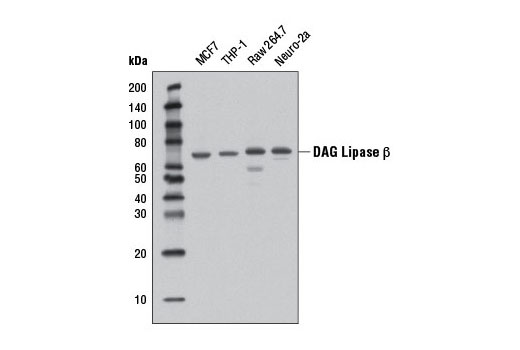 DAG Lipase β (D4P7C) Rabbit mAb
