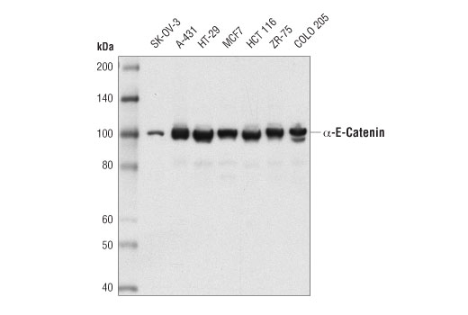 α-E-Catenin (D9R5E) Rabbit mAb