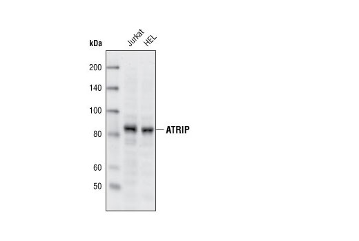 ATRIP Antibody