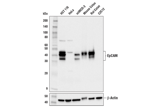 EpCAM (E8Q1Z) Rabbit mAb (Mouse Preferred)