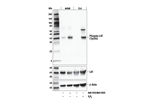 Phospho-LAT (Tyr255) (E3K6B) Rabbit mAb