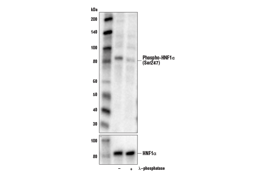 Phospho-HNF1α (Ser247) Antibody