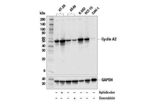 Cyclin A2 (E6D1J) Rabbit Monoclonal Antibody
