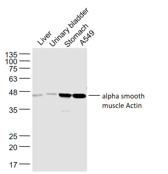 肌动蛋白a/a-SMA/a Actin抗体