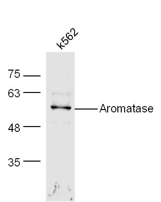 芳香化酶/细胞色素P450/雌激素合成酶抗体