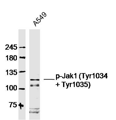 磷酸化蛋白质酪氨酸激酶JAK-1抗体