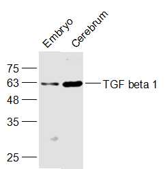 转化生长因子b1/TGF b1/TGF-b1抗体